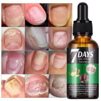 Huile d'ongle "7 nail solution"