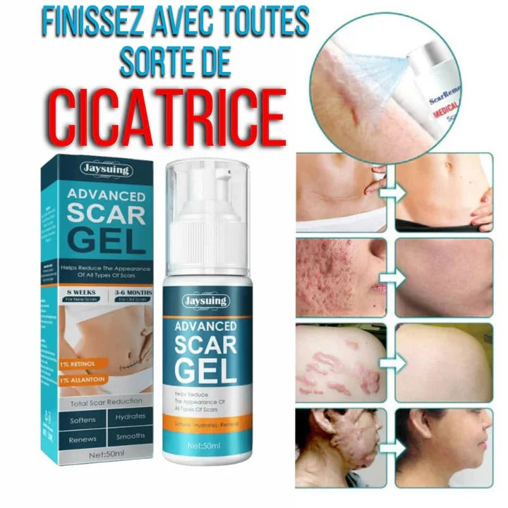 SCAR GEL CICATRICE – DITES ADIEU AUX CICATRICES !